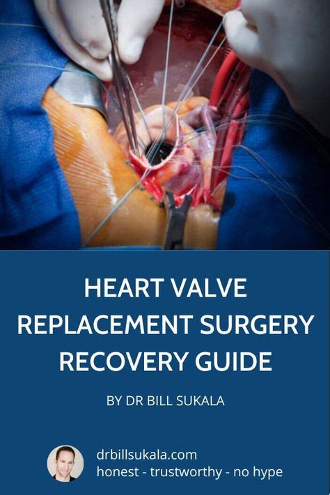 Most people spend 3 to 7 days in the hospital. . Exercise after heart valve replacement surgery